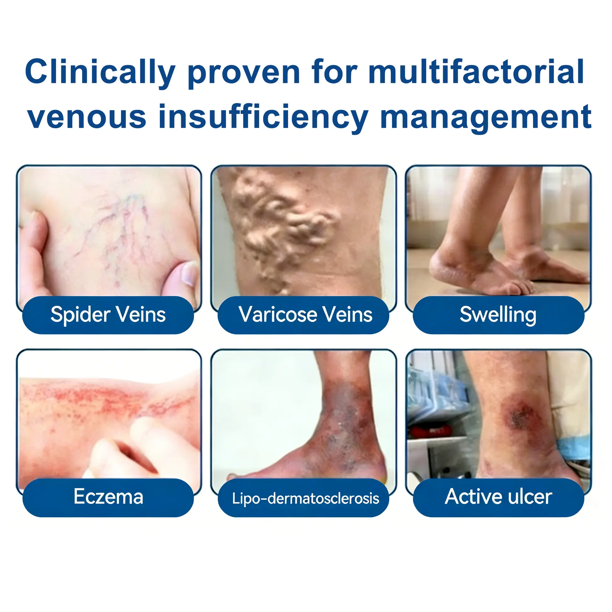 ๐๐๐๐๐๐๐๐ ๐บ๐๐ค๐๐ฎ |๐ก๏ธ๐ก๏ธ๐ก๏ธ๐๐๐ซ๐๐๐ฉ๐ฅ๐ข๐๐ญยฎ ๐๐น๐๐๐๐น๐ & ๐๐๐๐๐๐๐น๐๐น๐ ๐๐น๐ข๐ง๐ข๐๐๐น-๐๐ซ๐๐๐ฒ ๐
๐จ๐ซ๐ฆ๐ฎ๐น๐ ๐๐ข๐๐ซ๐จ๐ง๐ฒ๐ฒ๐๐น๐ ๐๐๐ญ๐๐ก๐น๐๐ฑ๐๐ฎ๐ป๐ฐ๐ฒ๐ฑ ๐๐ฒ๐ฟ๐ฏ๐ฎ๐น ๐๐น๐ฒ๐ป๐ฑ ๐ง๐ฎ๐ฟ๐ด๐ฒ๐๐ ๐ฆ๐ฝ๐ถ๐ฑ๐ฒ๐ฟ ๐ฉ๐ฒ๐ถ๐ป๐ & ๐ฅ๐ฒ๐น๐ถ๐ฒ๐๐ฒ๐ ๐๐ฒ๐ฎ๐๐, ๐ง๐ถ๐ฟ๐ฒ๐ฑ ๐๐ฒ๐ด๐