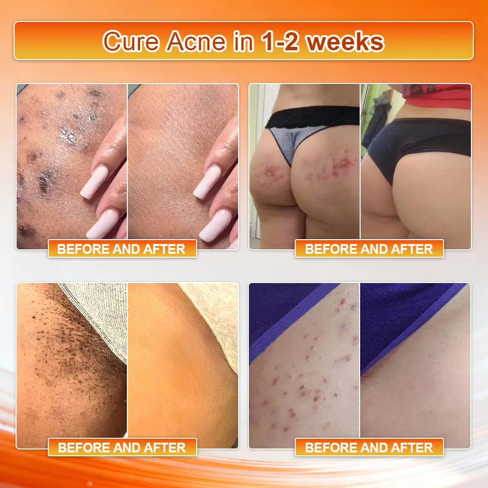 ๐๐๐๐๐ข๐๐ข๐๐ฅ ๐๐ซ๐๐ง๐ ๐๐ญ๐จ๐ซ๐ | Von๐ข๐ก๐๐ยฎ ๐๐๐๐ ๐๐จ๐ซ๐ข๐ง๐ ๐ & ๐๐๐ซ๐๐๐ซ๐ข๐ง๐ ๐-๐๐ง-๐ ๐๐ข๐๐ซ๐จ
โ CareUpliftยฎ