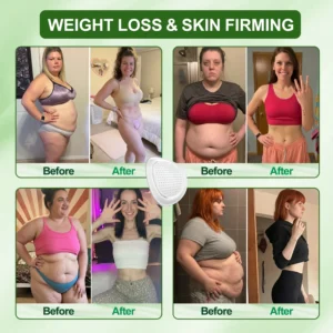 ✅ 𝐃𝐑.𝐇𝐎𝐍𝐎𝐑® ☘️ Lymphatic Drainage Slimming NanoMicroneedle Patch: Ultr
 – CareUplift®