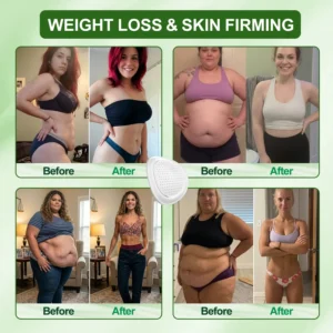 ✅ 𝐃𝐑.𝐇𝐎𝐍𝐎𝐑® ☘️ Lymphatic Drainage Slimming NanoMicroneedle Patch: Ultr
 – CareUplift®