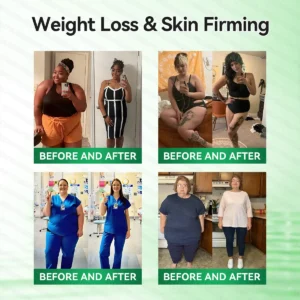 𝑶𝒇𝒇𝒊𝒄𝒊𝒂𝒍 𝑺𝒕𝒐𝒓𝒆  |🍀🍀𝐂𝐚𝐫𝐞𝐔𝐩𝐥𝐢𝐟𝐭® 𝑴𝒆𝒕𝒂𝒃𝒐𝒍𝒊𝒄 𝑵𝒂𝒏𝒐 𝑴𝒊𝒄𝒓𝒐𝒏𝒆𝒆𝒅𝒍𝒆 𝑷𝒂𝒕𝒄𝒉🇺🇸(𝐉𝐮𝐬𝐭 𝐨𝐧𝐜𝐞 𝐚 𝐝𝐚𝐲）𝘽𝙚𝙧𝙗𝙚𝙧𝙞𝙣𝙚 + 𝙈𝙤𝙧𝙞𝙣𝙜𝙖 𝙁𝙤𝙧𝙢𝙪𝙡𝙖 ✅ 𝐅𝐨𝐫 𝐨𝐛𝐞𝐬𝐢𝐭𝐲, 𝗟𝗼𝗼𝘀𝗲 𝘀𝗸𝗶𝗻,𝐝𝐢𝐚𝐛𝐞𝐭𝐞𝐬, 𝐬𝐥𝐞𝐞𝐩 𝐚𝐩𝐧𝐞𝐚, 𝐣𝐨𝐢𝐧𝐭 𝐢𝐬𝐬𝐮𝐞𝐬, 𝐚𝐧𝐝 𝐦𝐨𝐫𝐞💯