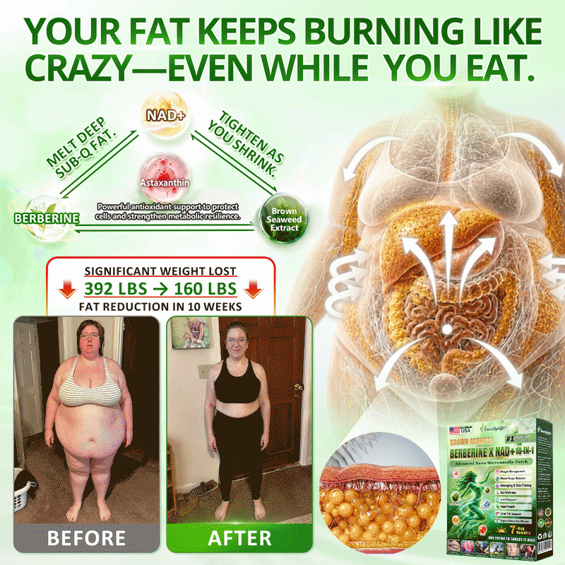 𝑶𝒇𝒇𝒊𝒄𝒊𝒂𝒍 𝑺𝒕𝒐𝒓𝒆 | 𝐍𝐞𝐰!🍀𝐂𝐚𝐫𝐞𝐔𝐩𝐥𝐢𝐟𝐭® 𝐁𝐫𝐨𝐰𝐧 𝐒𝐞𝐚𝐰𝐞𝐞𝐝× 𝐁𝐞𝐫𝐛𝐞𝐫𝐢𝐧𝐞× 𝐍𝐃𝐀+ 𝟏𝟎-𝐢𝐧
– 𝑪𝒂𝒓𝒆𝑼𝒑𝑳𝒊𝒇𝒕