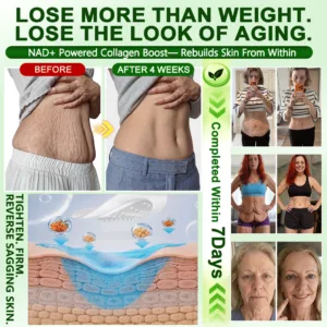 𝑶𝒇𝒇𝒊𝒄𝒊𝒂𝒍 𝑺𝒕𝒐𝒓𝒆 | 𝐍𝐞𝐰!🍀𝐂𝐚𝐫𝐞𝐔𝐩𝐥𝐢𝐟𝐭® 𝐁𝐫𝐨𝐰𝐧 𝐒𝐞𝐚𝐰𝐞𝐞𝐝× 𝐁𝐞𝐫𝐛𝐞𝐫𝐢𝐧𝐞× 𝐍𝐃𝐀+ 𝟏𝟎-𝐢𝐧
– 𝑪𝒂𝒓𝒆𝑼𝒑𝑳𝒊𝒇𝒕