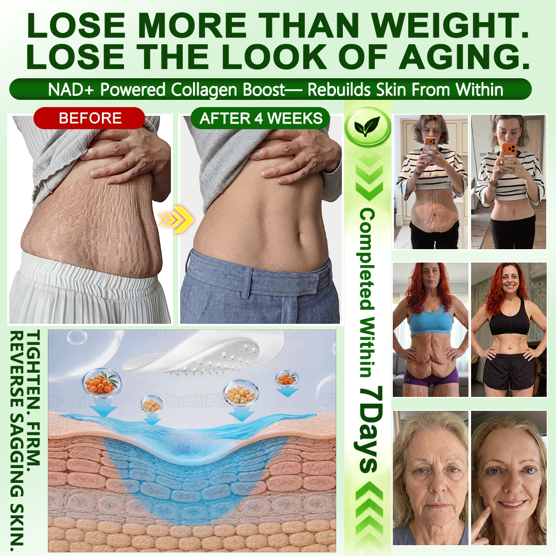𝑶𝒇𝒇𝒊𝒄𝒊𝒂𝒍 𝑺𝒕𝒐𝒓𝒆 | 𝐍𝐞𝐰!🍀𝐂𝐚𝐫𝐞𝐔𝐩𝐥𝐢𝐟𝐭® 𝐁𝐫𝐨𝐰𝐧 𝐒𝐞𝐚𝐰𝐞𝐞𝐝× 𝐁𝐞𝐫𝐛𝐞𝐫𝐢𝐧𝐞× 𝐍𝐃𝐀+ 𝟏𝟎-𝐢𝐧
– 𝑪𝒂𝒓𝒆𝑼𝒑𝑳𝒊𝒇𝒕